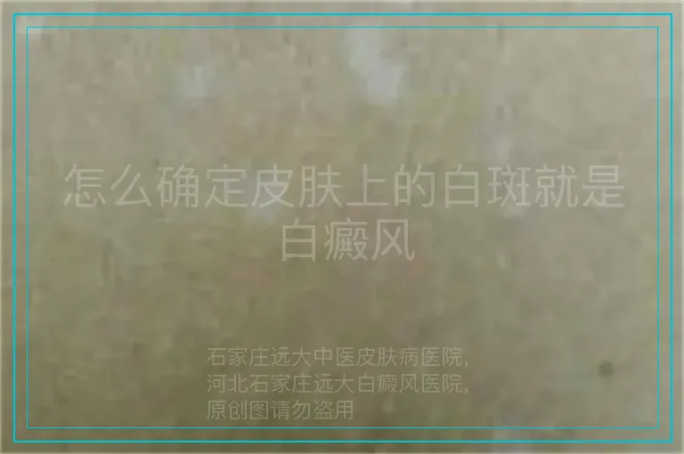 怎么确定皮肤上的白斑就是白癜风