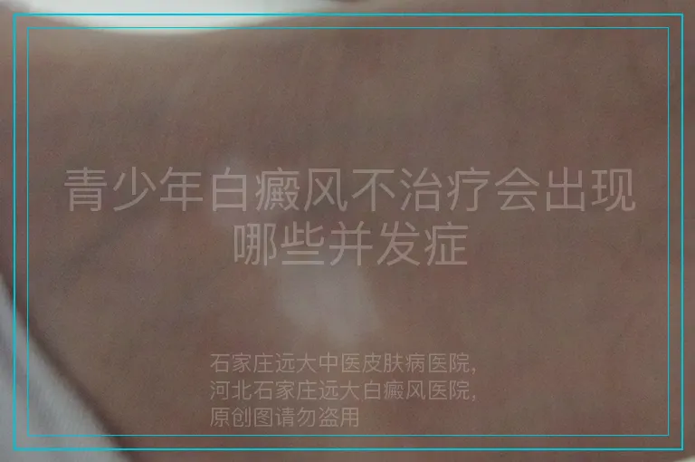 青少年白癜风不治疗会出现哪些并发症