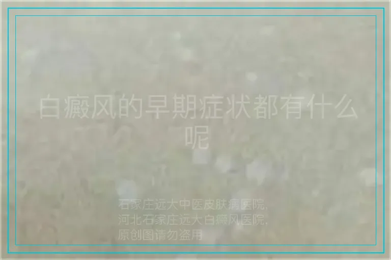 白癜风的早期症状都有什么呢