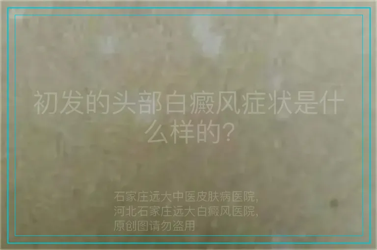 初发的头部白癜风症状是什么样的?