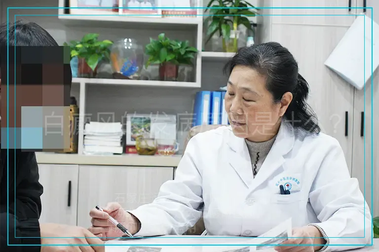 白癜风的发病原因是什么？