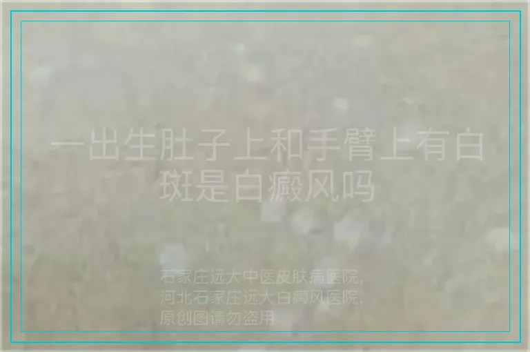 一出生肚子上和手臂上有白斑是白癜风吗