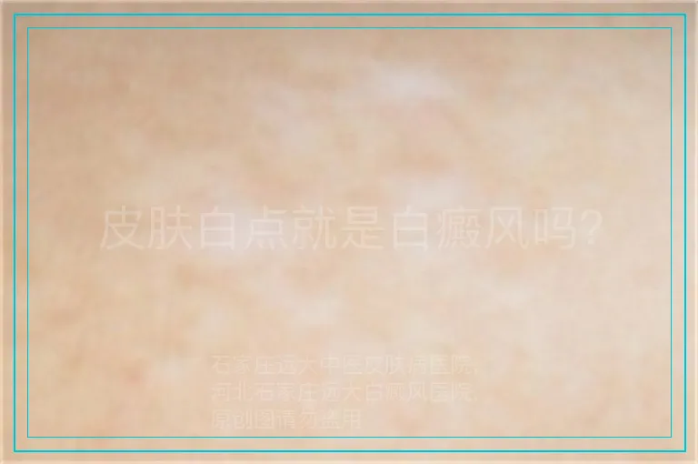 皮肤白点就是白癜风吗？