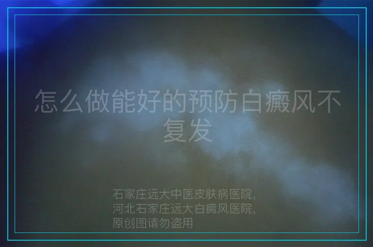 怎么做能好的预防白癜风不复发