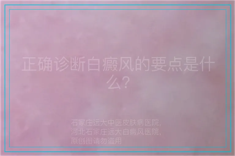 正确诊断白癜风的要点是什么？