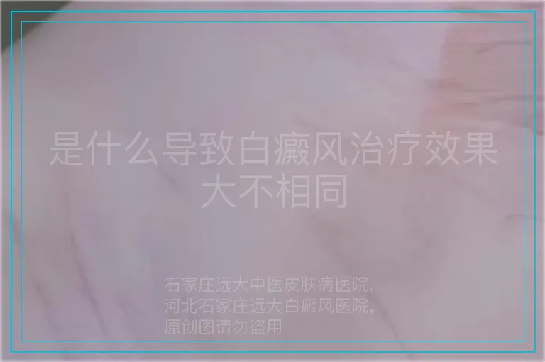 是什么导致白癜风治疗效果大不相同