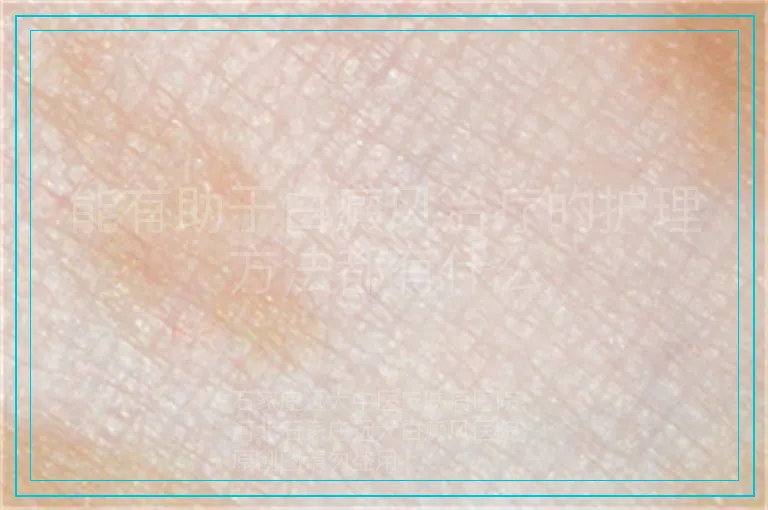 能有助于白癜风治疗的护理方法都有什么