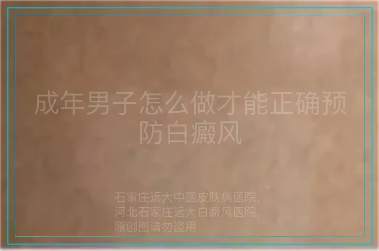 成年男子怎么做才能正确预防白癜风