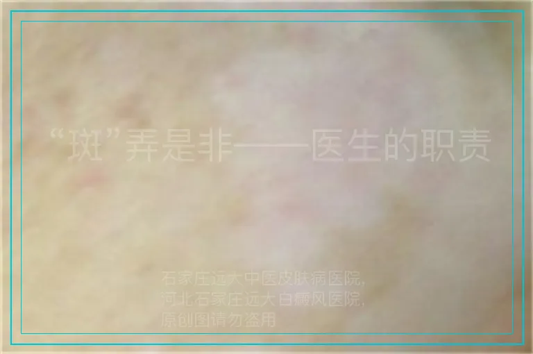 “斑”弄是非——医生的职责