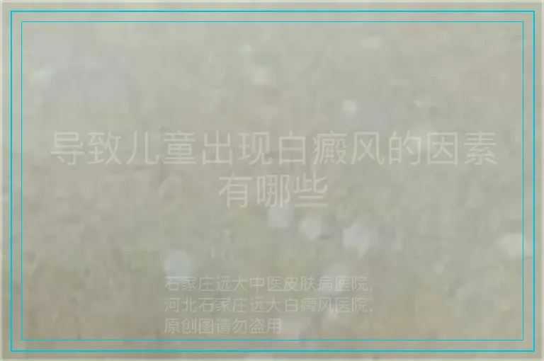 导致儿童出现白癜风的因素有哪些
