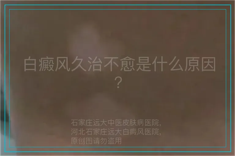 白癜风久治不愈是什么原因?