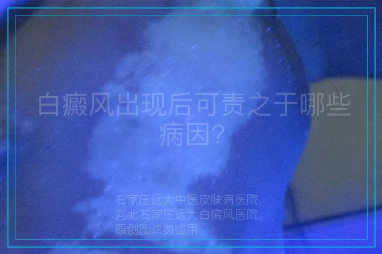白癜风出现后可责之于哪些病因?