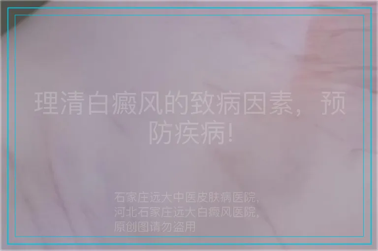理清白癜风的致病因素，预防疾病!
