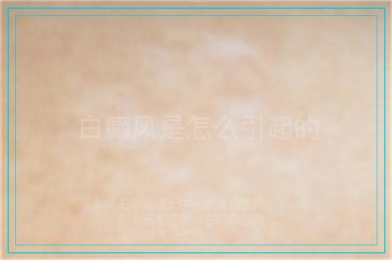 白癜风是怎么引起的
