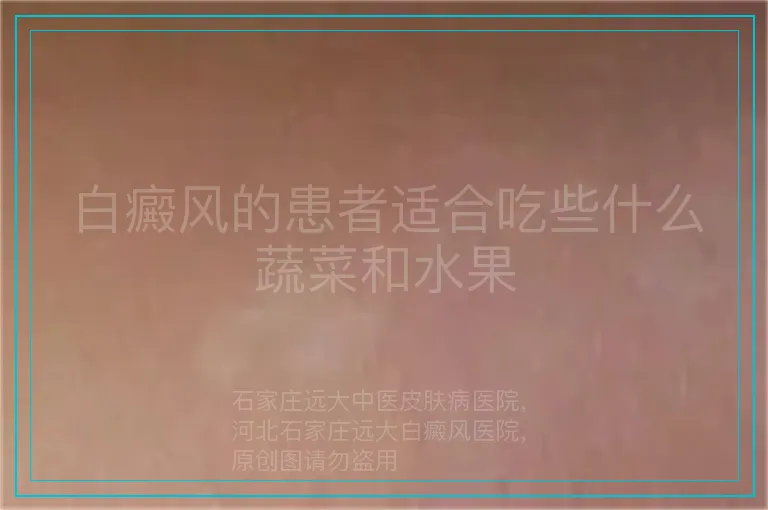 白癜风的患者适合吃些什么蔬菜和水果