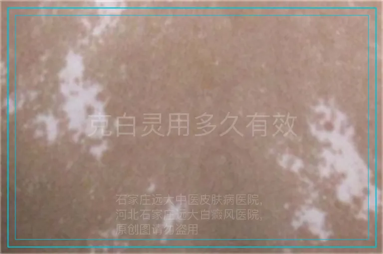 克白灵用多久有效