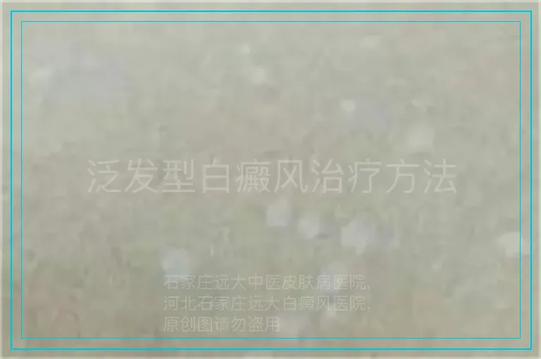 泛发型白癜风治疗方法
