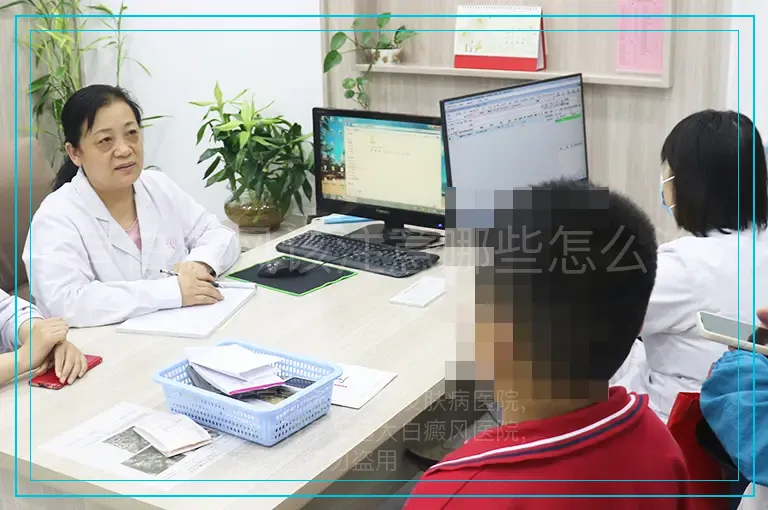 有白癜风该注意哪些怎么治