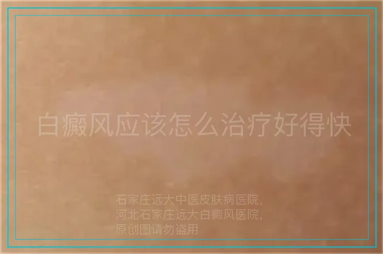 白癜风应该怎么治疗好得快
