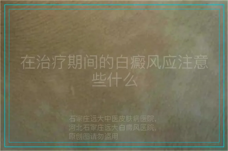 在治疗期间的白癜风应注意些什么