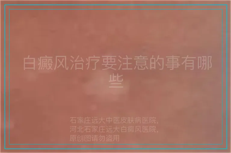 白癜风治疗要注意的事有哪些