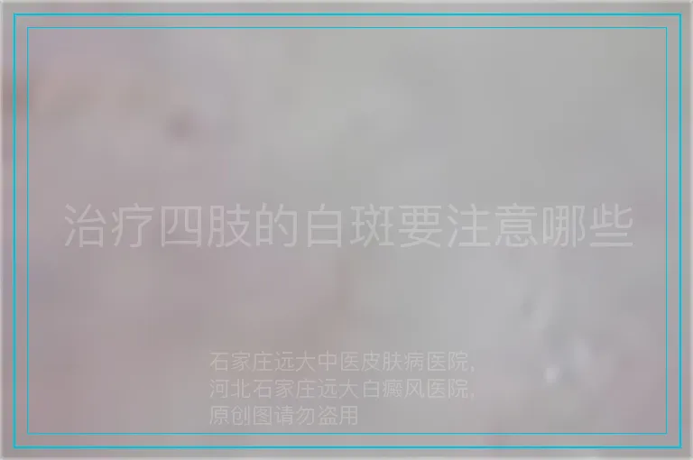 治疗四肢的白斑要注意哪些