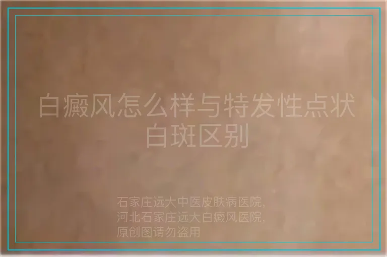 白癜风怎么样与特发性点状白斑区别