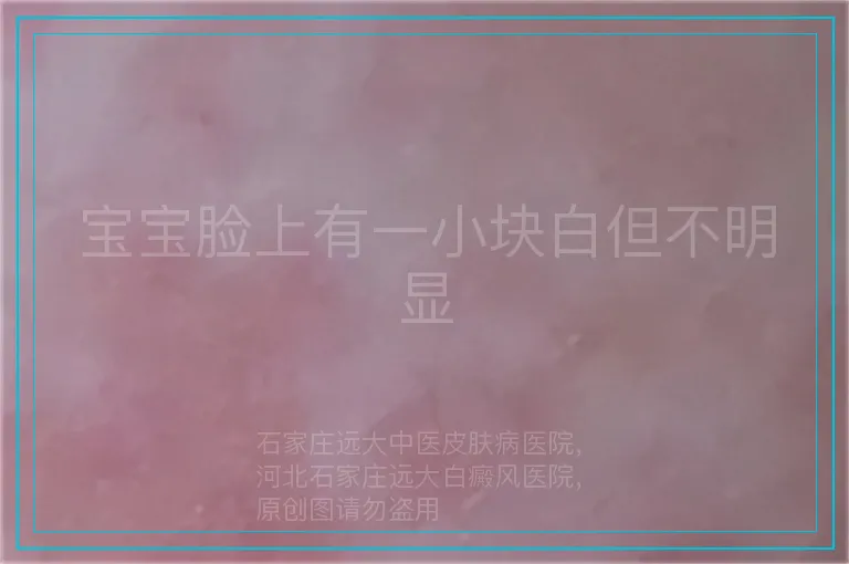 宝宝脸上有一小块白但不明显