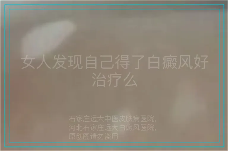 女人发现自己得了白癜风好治疗么