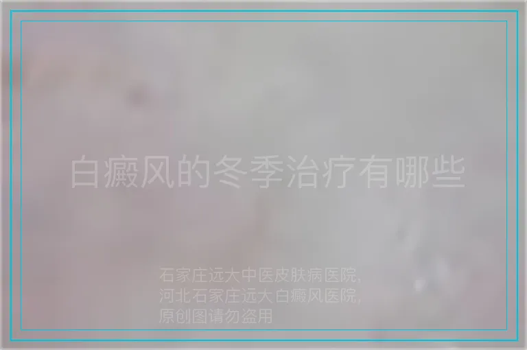 白癜风的冬季治疗有哪些