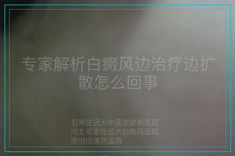 专家解析白癜风边治疗边扩散怎么回事