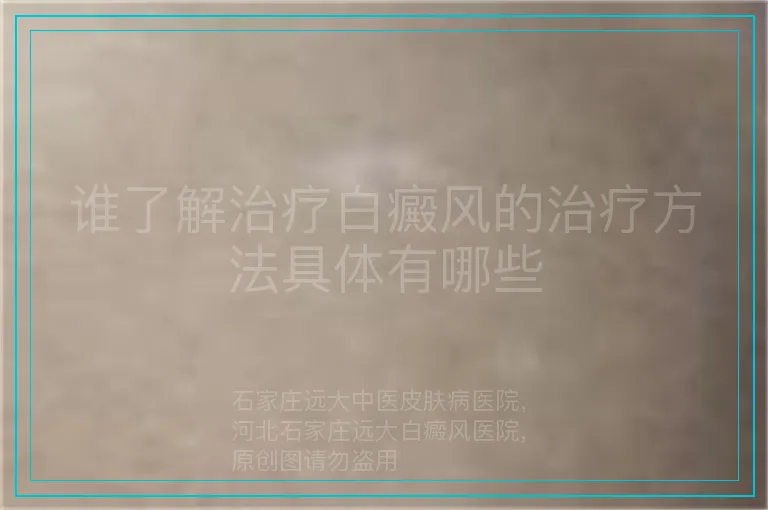谁了解治疗白癜风的治疗方法具体有哪些