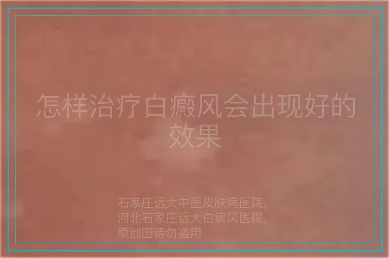 怎样治疗白癜风会出现好的效果