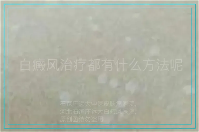 白癜风治疗都有什么方法呢