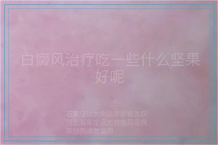 白癜风治疗吃一些什么坚果好呢