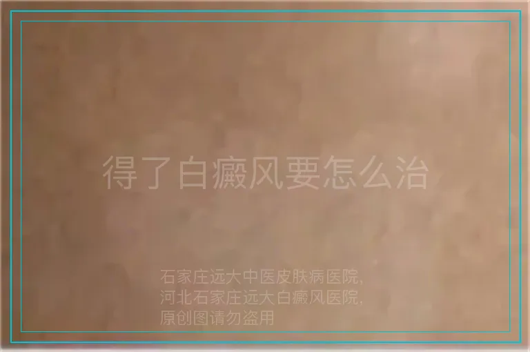 得了白癜风要怎么治