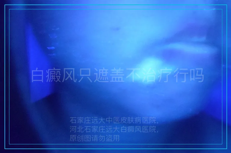 白癜风只遮盖不治疗行吗
