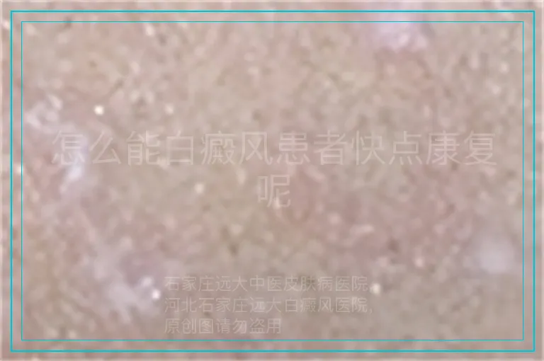 怎么能白癜风患者快点康复呢