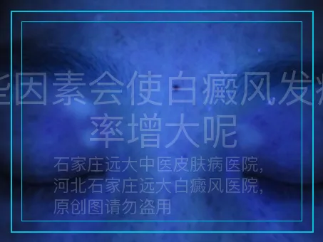 哪些因素会使白癜风发病概率增大呢