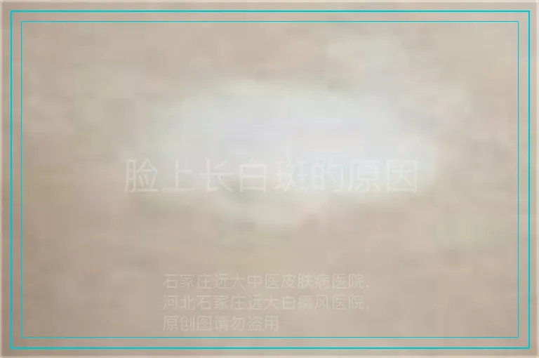 脸上长白斑的原因