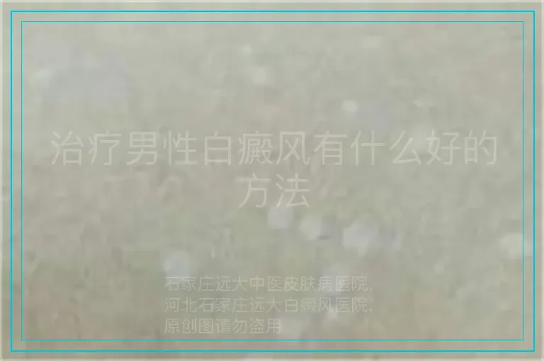 治疗男性白癜风有什么好的方法
