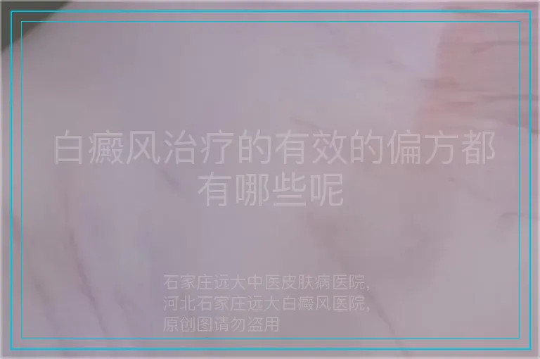 白癜风治疗的有效的偏方都有哪些呢