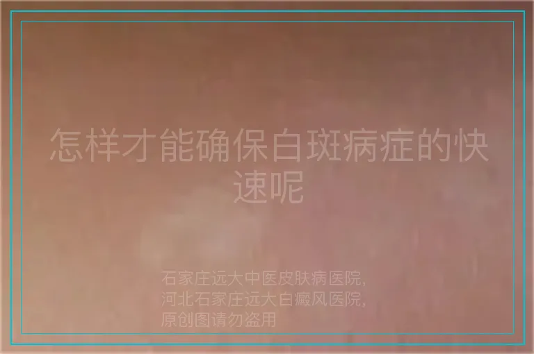怎样才能确保白斑病症的快速呢