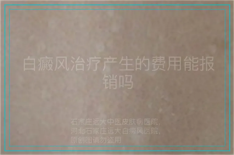 白癜风治疗产生的费用能报销吗