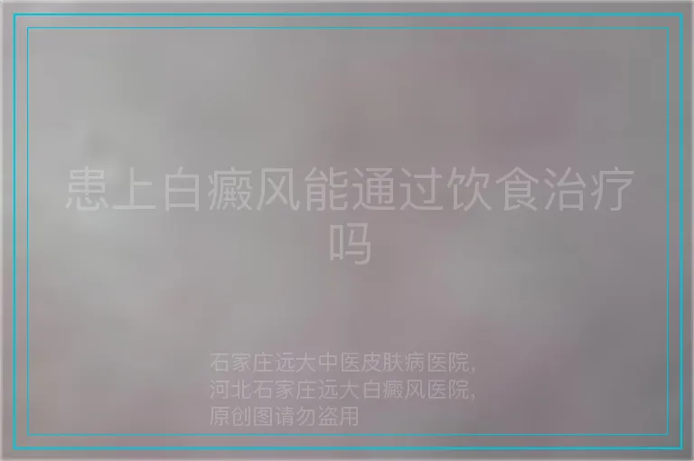 患上白癜风能通过饮食治疗吗