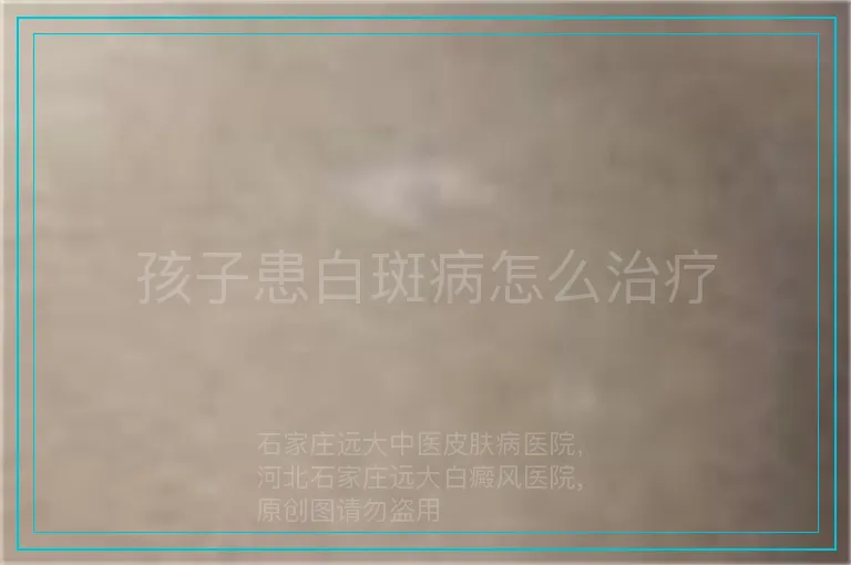 孩子患白斑病怎么治疗