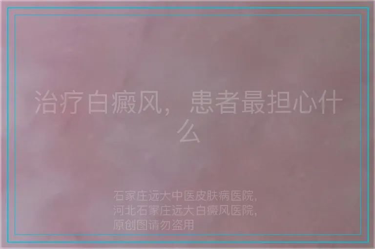 治疗白癜风,患者最担心什么