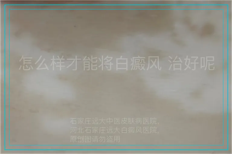 怎么样才能将白癜风 治好呢