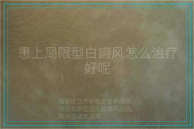 患上局限型白癜风怎么治疗好呢