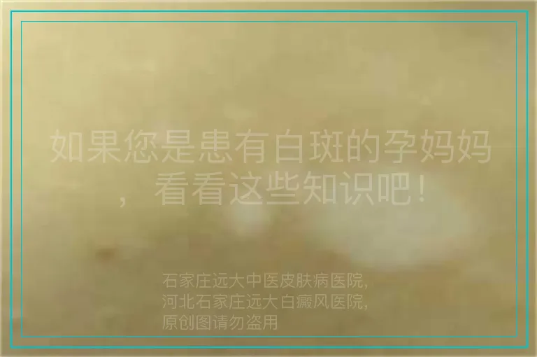 如果您是患有白斑的孕妈妈，看看这些知识吧！